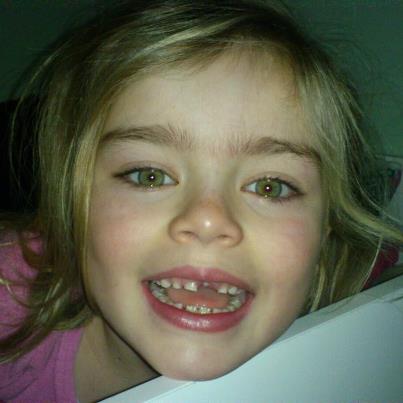 A visit from the tooth fairy