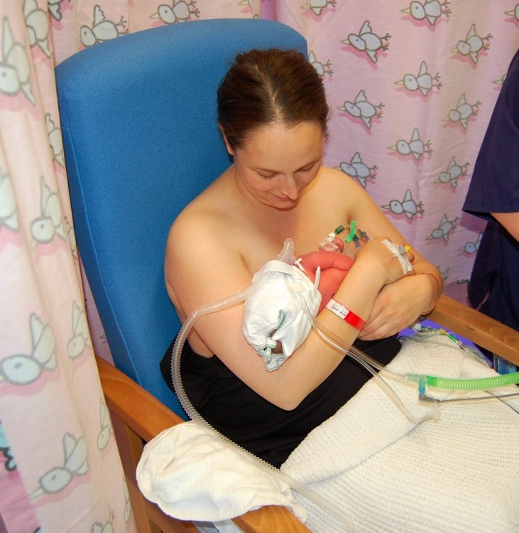 Breastfeeding 1,2 and 3