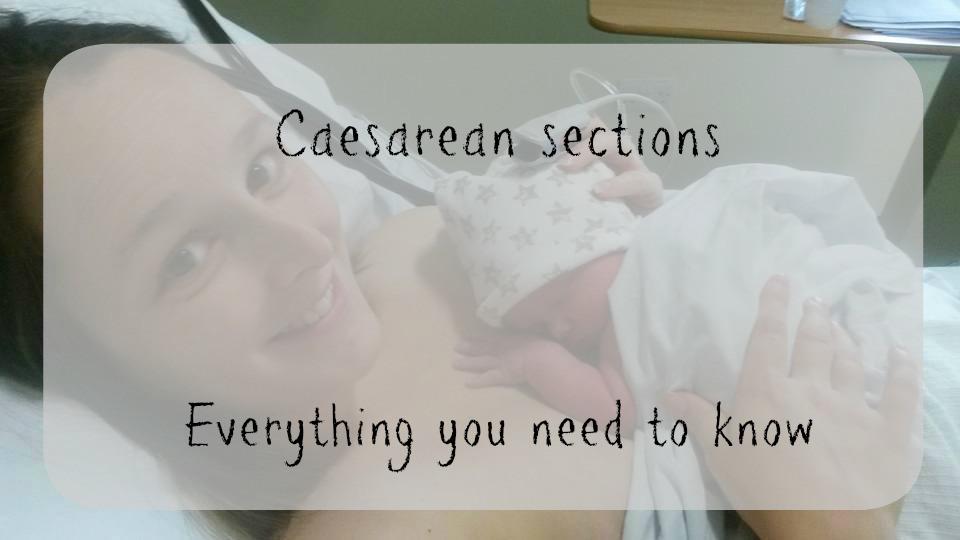 Everything you need to know about caesareans