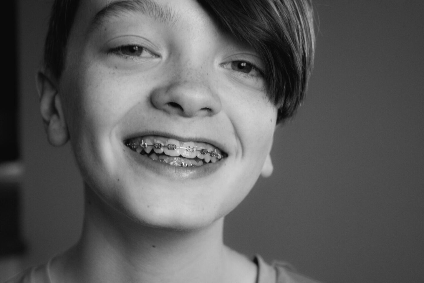 Understanding how braces work